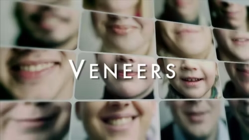 Veneers